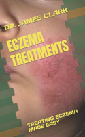 Eczema Treatments