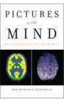 Pictures of the Mind