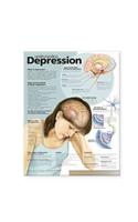 Understanding Depression Anatomical Chart