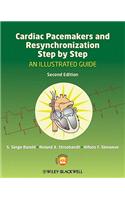 Cardiac Pacemakers and Resynchronization Step by Step