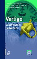 Vertigo: Leitsymptom Schwindel