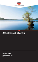 Attelles et stents