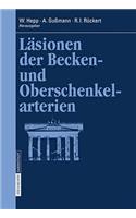 Läsionen Der Becken- Und Oberschenkelarterien