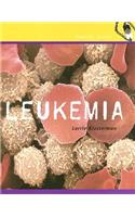 Leukemia