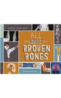 All about Broken Bones
