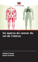 aperçu du cancer du col de l'utérus
