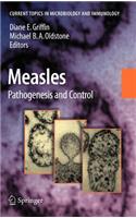 Measles