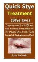 Quick Stye Treatment (Stye Eye)