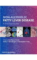 Non-Alcoholic Fatty Liver Disease