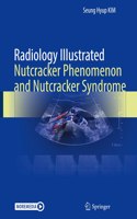 Radiology Illustrated: Nutcracker Phenomenon and Nutcracker Syndrome