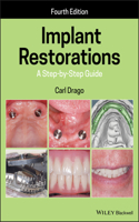 Implant Restorations: A Step-By-Step Guide