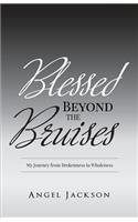 Blessed Beyond the Bruises