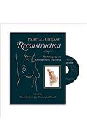 Partial Breast Reconstruction: Techniques in Oncoplastic Surgery