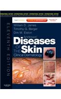Andrews' Diseases Of The Skin, International Edition With Expert Consult – Online And Print