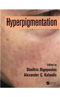 Hyperpigmentation