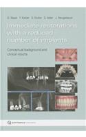 Immediate Restorations with a Reduced Number of Implants