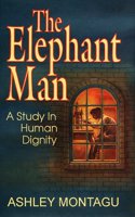 The Elephant Man