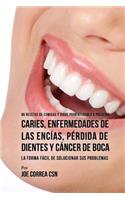 86 Recetas de Comidas y Jugos Para Ayudarle A Prevenir Caries, Enfermedades de Las Encías, Pérdida de Dientes y Cáncer de Boca: La Forma Fácil de Solucionar Sus Problemas