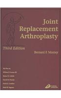 Joint Replacement Arthroplasty