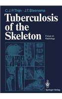 Tuberculosis of the Skeleton