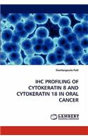 Ihc Profiling of Cytokeratin 8 and Cytokeratin 18 in Oral Cancer