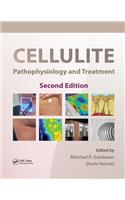 Cellulite: Pathophysiology and Treatment