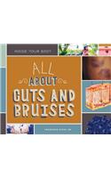 All about Cuts and Bruises