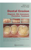 Dental Erosion