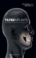 Tilted Implants