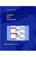 Lumbar Disc Herniation