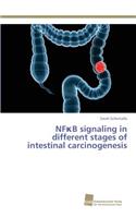 NFκB signaling in different stages of intestinal carcinogenesis: (English)