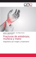 Fracturas de antebrazo, muñeca y mano