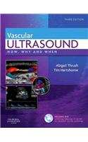 Vascular Ultrasound