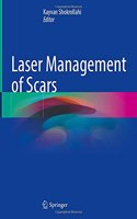 Laser Management of Scars