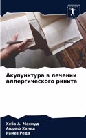 Акупунктура в лечении аллергического рин