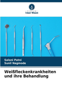 Weißfleckenkrankheiten und ihre Behandlung