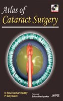 Atlas of Cataract Surgery (with DVD-ROM)