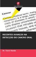 Recentes Avanços Na Detecção Do Cancro Oral