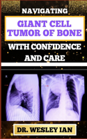 Navigating Giant Cell Tumor of Bone with Confidence and Care