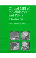 CT and MRI of the Abdomen and Pelvis