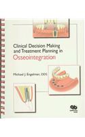 Clinical Decision Making and Treatment Planning in Osseointegration