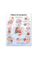 Dangers of Smoking Anatomical Chart in Spanish (Peligros del tabaquismo)