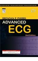 Advanced ECG: Boards and Beyond, 2/e