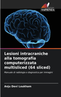 Lesioni intracraniche alla tomografia computerizzata multisliced (64 sliced)