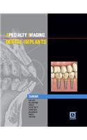 Specialty Imaging: Dental Implants