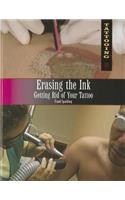 Erasing the Ink: Getting Rid of Your Tattoo(Tattooing)