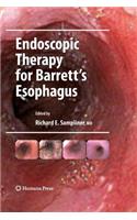 Endoscopic Therapy for Barrett's Esophagus