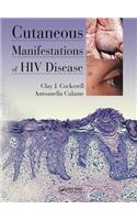 Cutaneous Manifestations of HIV Disease