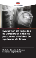 Évaluation de l'âge des os vertébraux chez les personnes atteintes du syndrome de Down