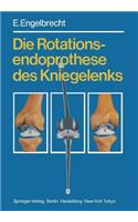 Die Rotationsendoprothese des Kniegelenks